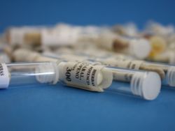 吉利德科学(GILD.US):瑞德西韦治疗新冠患者的回顾性研究取得积极数据
